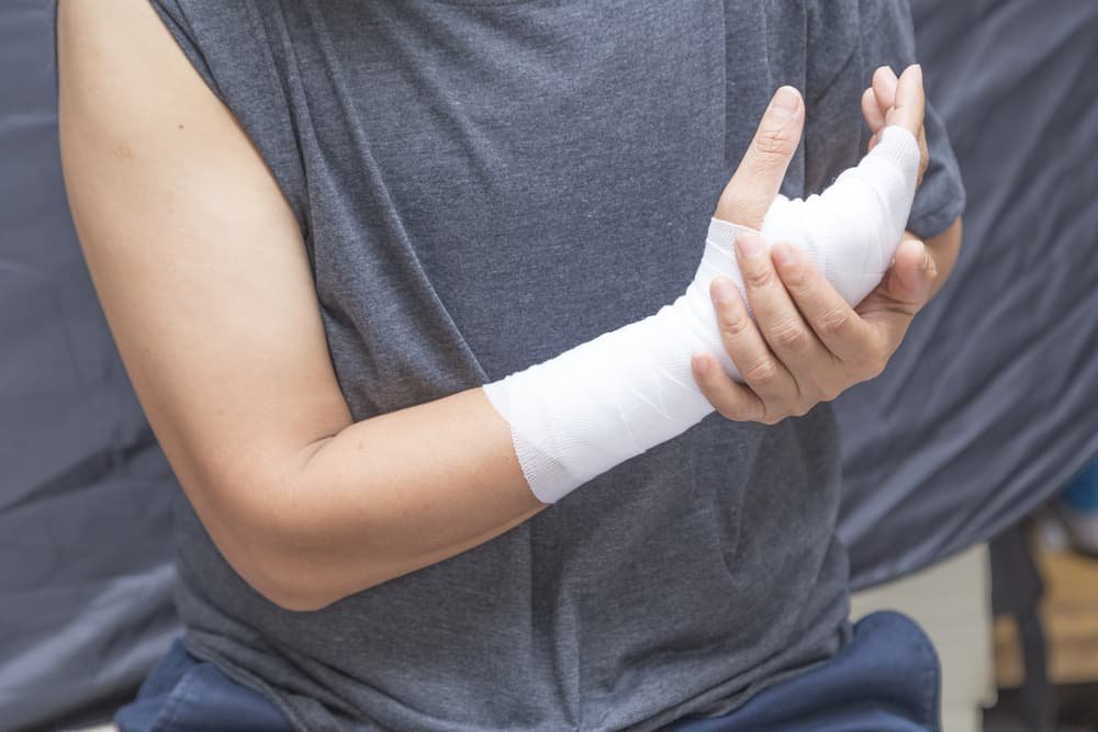 a person with an injured arm